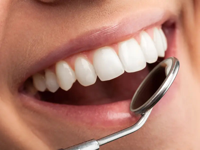 dentist internet marketing Smile with dental mirror reflection.